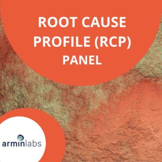 Root cause profile2